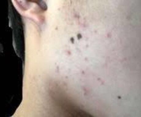 肌のお悩みの相談乗ります 肌荒れ、乾燥肌、毛穴がきになる方へ イメージ2