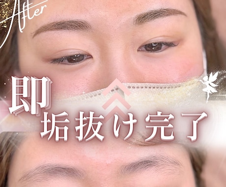 アートメイク看護師が普段の眉の運用アドバイスします 普段の眉の左右差のお悩み、運用に悩んでる方におすすめ！ イメージ2