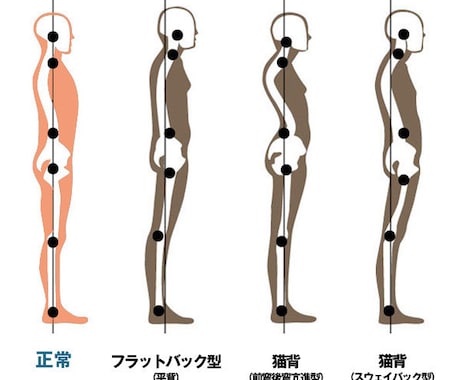 体の重心バランスのズレを鼻緒テーピング法ます イメージ1
