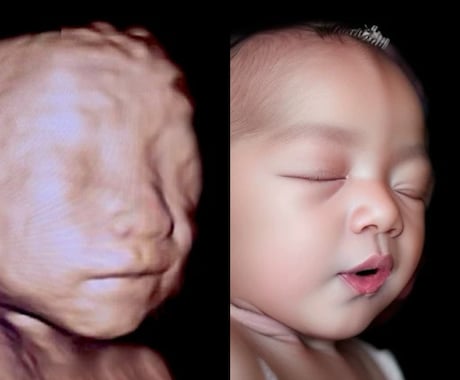 AIでエコー写真から赤ちゃんのお顔を予測します 未来の可愛いお顔を先取り、ワクワクが止まらない イメージ2