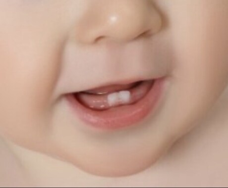 子どものお口のお悩み解決致します 小児歯科衛生士10年のベテランが相談のります！ イメージ1