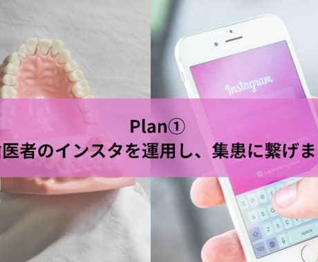 Plan①歯医者のインスタを運用し、集患に繋げます 歯科衛生士免許保有！あなたの歯科医院の魅力を発信します！ イメージ1