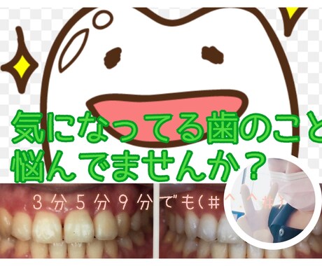 お口の気になること教えます 歯科衛生士があなたの気になってる症状、悩みなどお答えします イメージ1