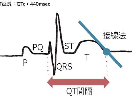 心電図検定1級が心電図検定試験に向け相談に応じます 臨床・試験対策・症例読影まで幅広く対応！ イメージ2