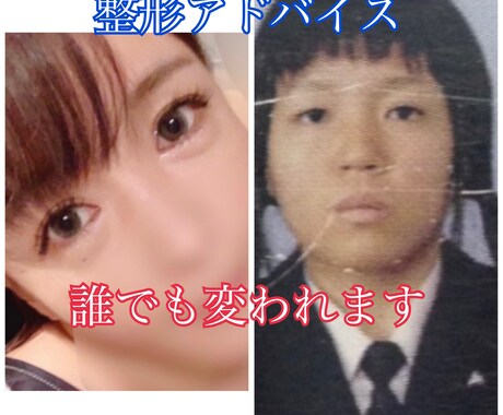 整形で人生180度変わった私がアドバイスします 女は結局外見でした。生まれ変わって人生変えましょう。 イメージ1