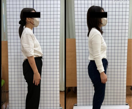 あなたの姿勢写真から姿勢改善トレーニングを教えます 必要なトレーニングだけではなく、睡眠、栄養アドバイスも！ イメージ1