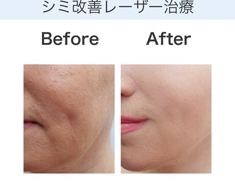 美容クリニック向けSNS投稿デザイン作成します 清潔感のあるデザインで施術紹介・お知らせに最適 イメージ2