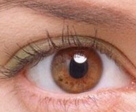 眼科、眼の病気についての相談 イメージ1