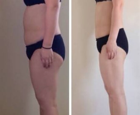 あなたのダイエットにアドバイスします 今ダイエット中でなかなか結果のでない方に イメージ1