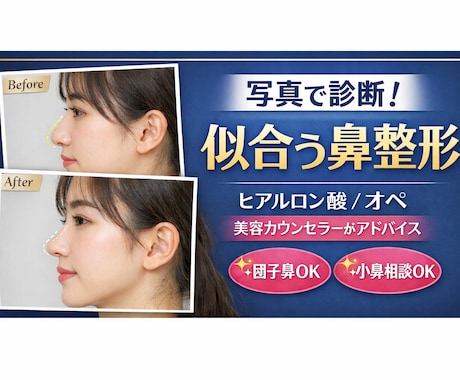 写真で診断！あなたに似合う鼻整形提案します 現役カウンセラーが自然なデザインができる施術提案します！ イメージ1
