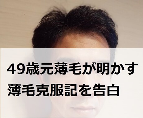 49歳薄毛ハゲを克服した経緯を詳らかにお教えします アラフィフでも大丈夫!私が薄毛ハゲを克服した経緯を全て公開 イメージ1