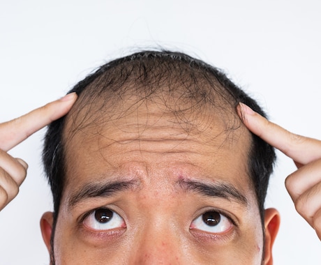 男性必見！友達感覚で薄毛相談できます 薄毛のプロが自分磨きのお手伝いをします！ イメージ1