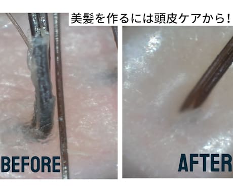 頭皮・ヘッドスパの専門相談にのります 頭皮タイプ診断と最適ケアをプロが提案します イメージ1