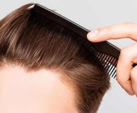 抜け毛！かゆみの原因は？簡単な頭皮診断をします 男女問わず自分に合うヘアケアを美容師以外から聞きたい方へ イメージ1