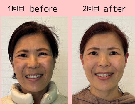 理想のお顔にデザイン、あなたの魅力を引き出します 正しい表情筋の使い方を知り日常に落とし込み、別人級に変化 イメージ2
