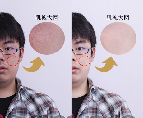 美肌補正から写込みの削除まで写真の加工編集承ります 【現役photoshoper】貴方の写真がより一層輝きます！ イメージ2
