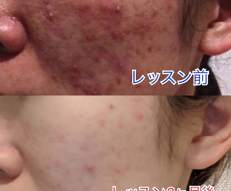 最近の美肌術を教えます イメージ1