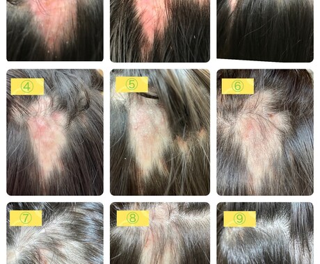 髪の悩みは心の悩み。毛髪診断士が丁寧に向き合います 毛髪診断士が寄り添う女性と子どもの脱毛相談室 イメージ2