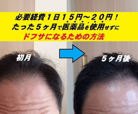 ミノキシジル無しでこの効果！写真のように改善します いつまでミノタブ、フィンペシアの副作用で消耗してるんですか？ イメージ1
