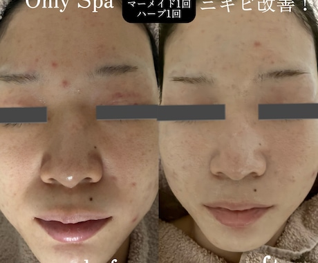 初心者男性必見！お店に行かず！かっこよくします 【今流行り】オンラインエステでかっこよく綺麗に！ イメージ2