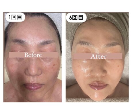 頭蓋骨小顔コルギの技術全て教えます 戻りにくい小顔技術を現役エステティシャンが全て教えます イメージ2