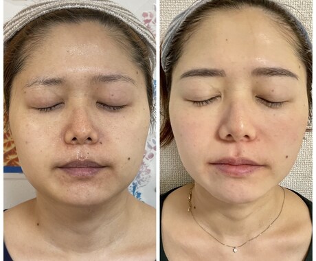 極秘！シミだらけの私が美肌を取り戻した方法教えます 実体験に基づいた方法です！(予告なしに値上げします) イメージ1