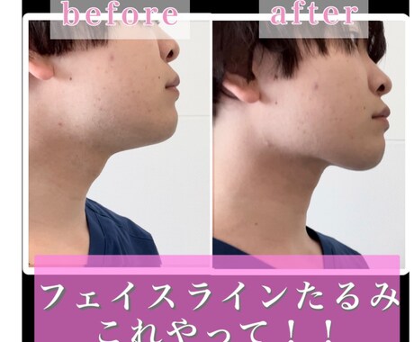 週2回、2ヶ月、小顔になれるアドバイス行います 東京都内で多くの芸能人を見た実績あり！国家資格持ちの為安心！ イメージ1