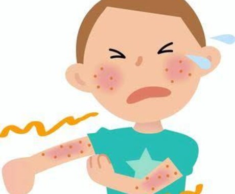 アトピー性皮膚炎の悩み解決します ステロイドは使いません！身近なもので楽になります イメージ1