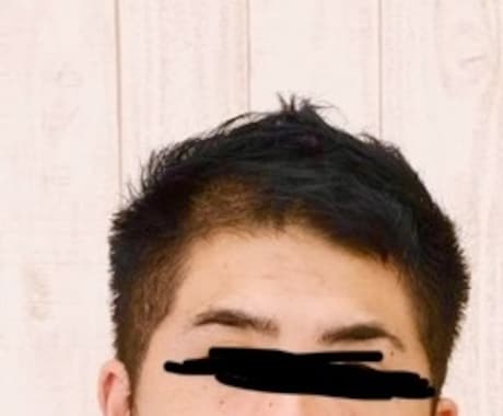 4年経過した【AGA治療】の経験談お話します 30歳でまさか薄くなるとは・・・お悩み共感します。 イメージ2