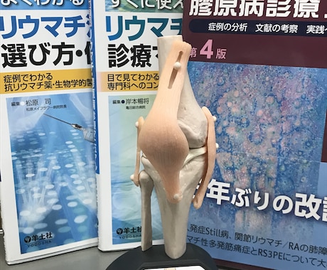 関節リウマチの病態や治療について解説します 関節リウマチについて知識を深めたい方へ イメージ1