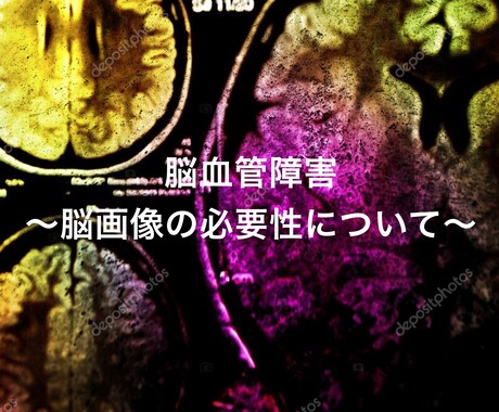リハビリの勉強資料をパワーポイントで提供します 脳画像、被殻のアプローチ、発達などなど イメージ1