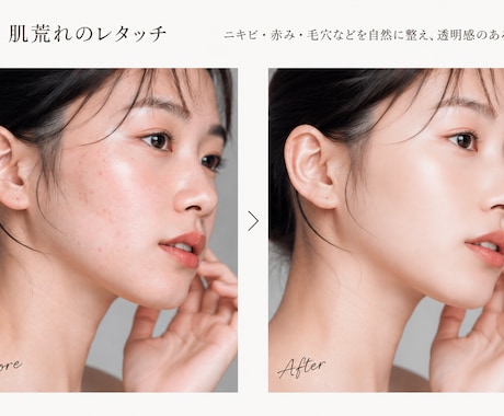 写真、画像のレタッチします SNS用、プロフィール、ウェディングフォトなど幅広く対応可能 イメージ2