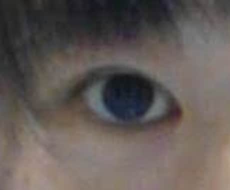 あなたの瞼にぴったりの二重にする方法を教えます テープか、のりか…どの方法がいいの？写真で診断できます！ イメージ2