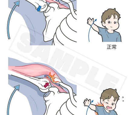 医療・看護・教材イラスト ポップな絵柄で制作します 健康フィットネス系、筋肉・骨格・臓器、医療器具etc… イメージ2