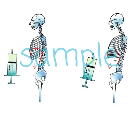 分かりやすい手書き医療系イラストを提供します 医療医学系の方向け！難しい医学をイラストで説明しませんか？ イメージ1