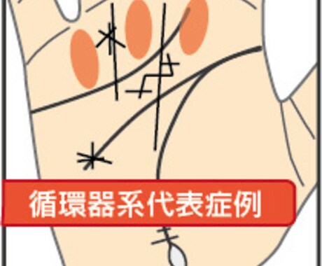 掌紋医学の手相診断で身体の弱い所をお伝えします 将来的疾患リスク、健康運を専門的な手相鑑定で簡単チェック イメージ1