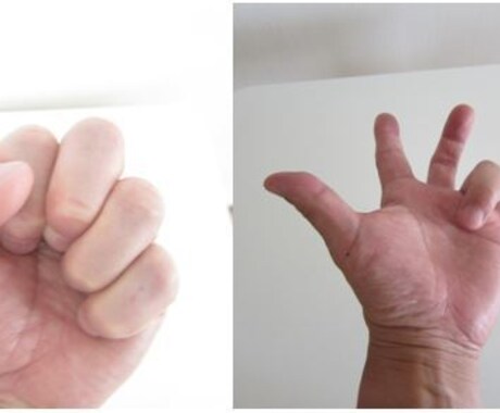 簡単な指体操だけで治る”ばね指”の治療法を教えます えッこんな簡単な指体操で！　即効性にきっと歓喜するでしょう。 イメージ2