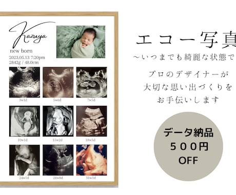 赤ちゃんの写真入りエコー写真ポスター作ります 大切な赤ちゃんの思い出をおしゃれに残しませんか？ イメージ2