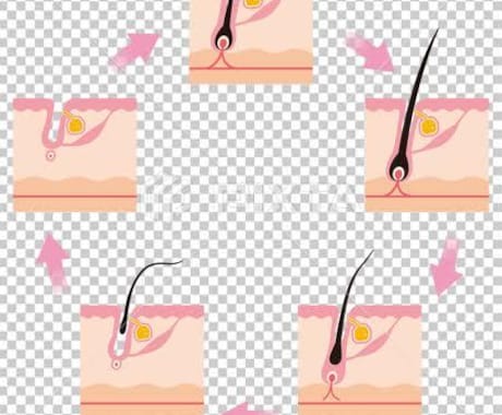 薬に頼らず抜け毛、薄毛を克服した発毛方法教えます ・発毛に必要なのは○○と○○！薄毛の対処は1日も早めが鍵！ イメージ2
