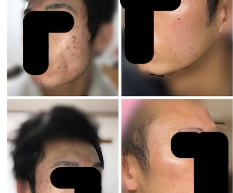 現役美容看護師が美肌のための提案をします 数十万の契約で後悔する前に！現役看護師が中立にアドバイス イメージ1