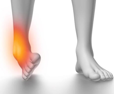 足関節捻挫のプロトコルを提供します 全トレーナー・治療家の為の知っておくべき足関節捻挫プロトコル イメージ1