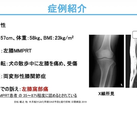 整形外科PTが学会・症例発表スライドを添削します 学会発表・症例発表を「伝わるスライド」にブラッシュアップ イメージ2