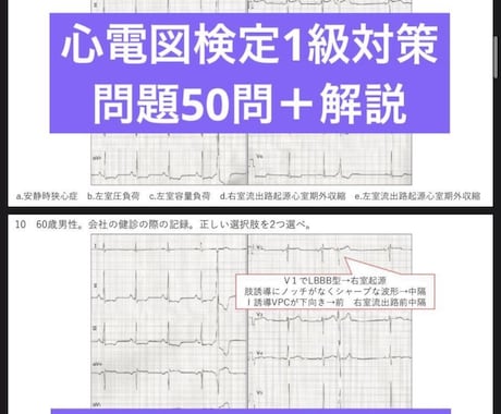 心電図検定1級対策を一緒にします 心電図検定1級を一発取得した看護師がアドバイスします！ イメージ2