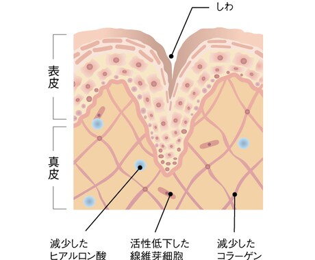 お肌の内部を描きます 化粧品の効果説明や皮膚の作りをわかりやすくお伝えします イメージ2
