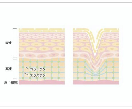 スキンケアの見直し・お肌トラブルの相談乗ります 元美容部員が全力で応援します。追加料金ナシ イメージ2