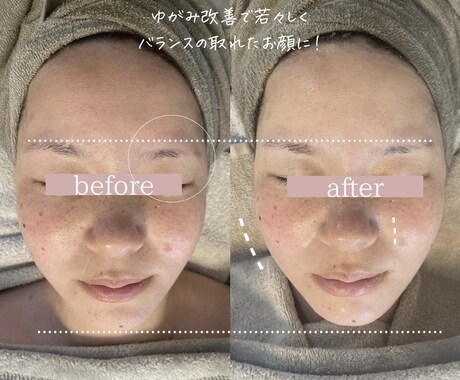頭蓋骨小顔コルギの技術全て教えます 戻りにくい小顔技術を現役エステティシャンが全て教えます イメージ1