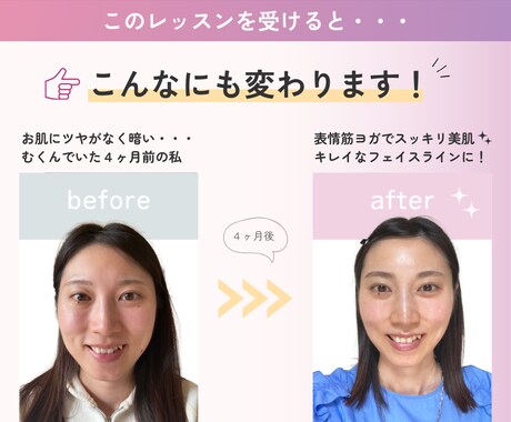 表情筋トレーニングで自然に若返る方法教えます いつまでもきれいでいたいママさん一緒に表情筋ヨガしましょう♡ イメージ2