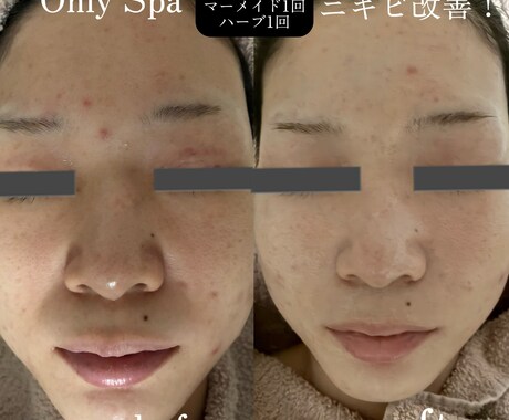 美容初心者大歓迎♪お肌の悩み相談お受けします 【美容初心者必見】流行のオンラインエステで店に足を運ばず綺麗 イメージ2