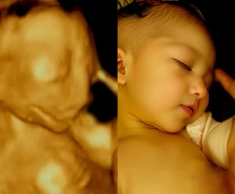 AIでエコー写真から赤ちゃんのお顔を予測します 未来の可愛いお顔を先取り、ワクワクが止まらない イメージ1