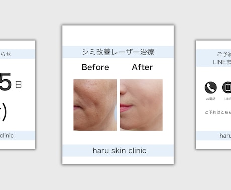 美容クリニック向けSNS投稿デザイン作成します 清潔感のあるデザインで施術紹介・お知らせに最適 イメージ1